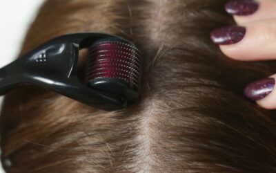 Derma Roller használata hajra